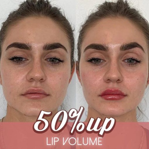 5 Mins Extreme Lip Plumper - Image 7