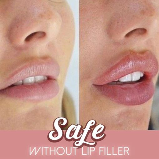 5 Mins Extreme Lip Plumper - Image 4