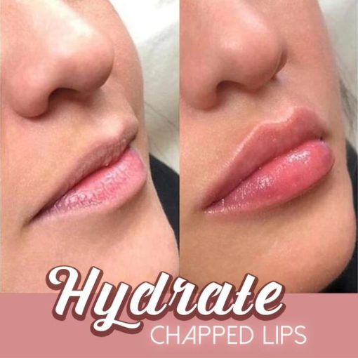 5 Mins Extreme Lip Plumper - Image 3