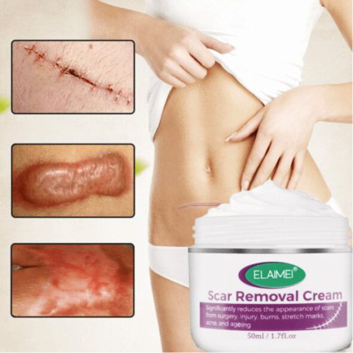 Skin Rebound Scarless Cream