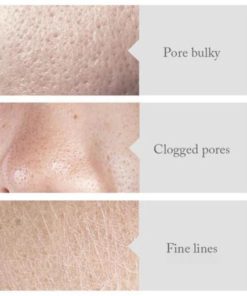 Poreless Skin Tightening Serum