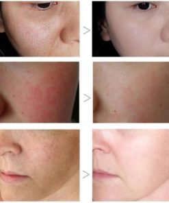 Poreless Skin Tightening Serum