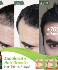 7X Rapid Growth Hair Treatment