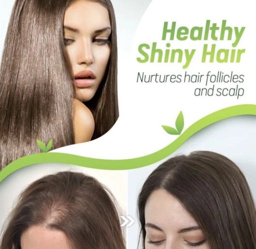 7X Rapid Growth Hair Treatment - Image 6