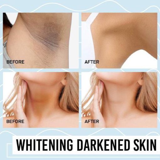 Armpit Whitening Magic Cream - Image 8