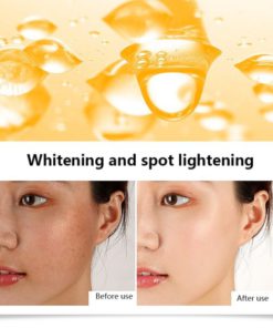 VC Whitening Freckle Serum