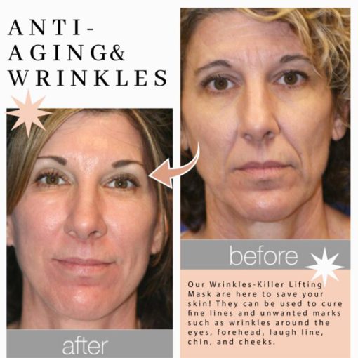 Wrinkles-Killer Lifting Mask