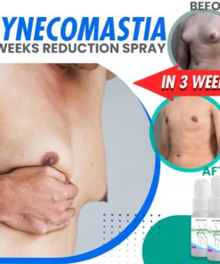 Gynecomastia 3 Weeks Cellulite Reduction Spray