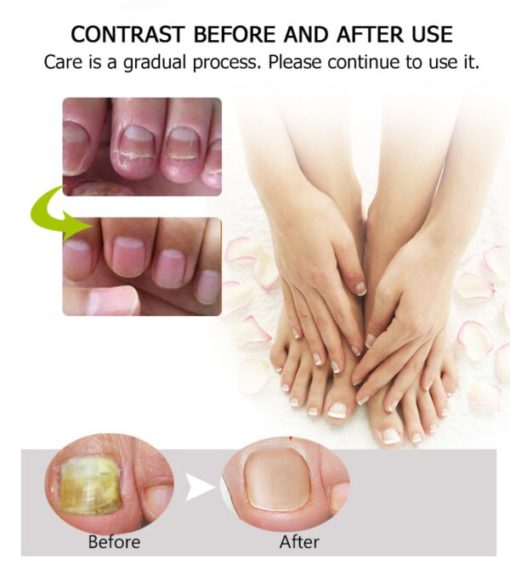 Toe Be Health Instant Beauty Gel - Image 2