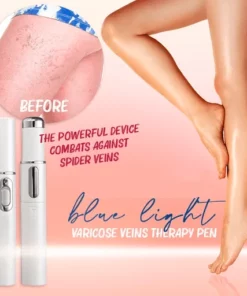 Blue Light Therapy Varicose Veins Pen