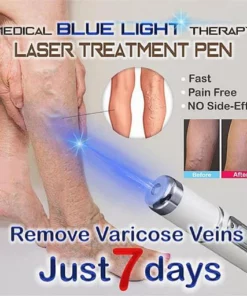 Blue Light Therapy Varicose Veins Pen