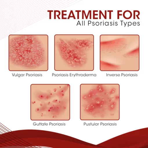 DermaCure Psoriasis Treatment Spray - Image 5