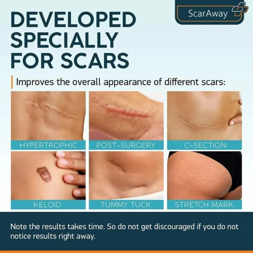 ScarAway PURI Advanced Scar Gel - Image 3