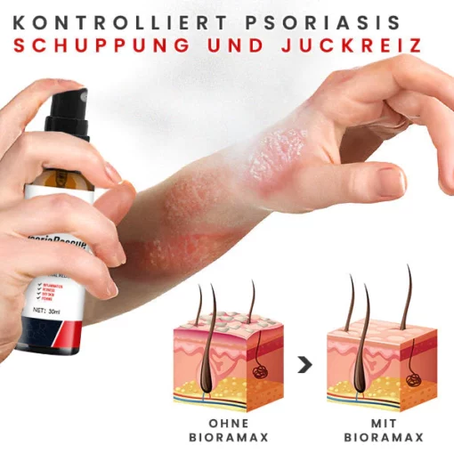 BIORAMAX PRO PsoriaRescue Behandlung Spray - Image 5