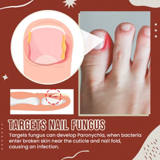 Nail Anti-Fungus Socks - Image 4