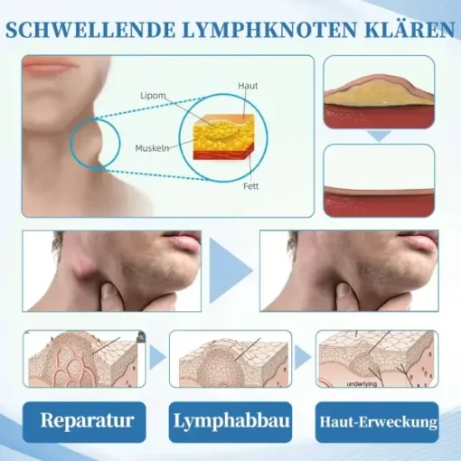 DOCTIA™ Tragbarer Multifunktionaler Naseninhalationsstift - Image 8