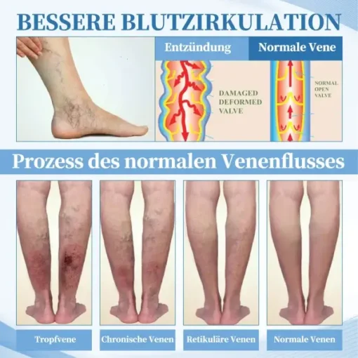 DOCTIA™ Tragbarer Multifunktionaler Naseninhalationsstift - Image 9